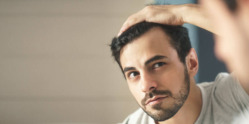 mens hair loss